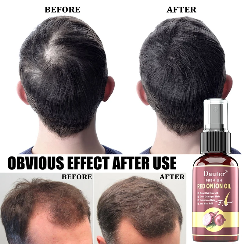 Prirodni sprej protiv opadanja kose s eteričnim uljem, njeguje suhe i oštećene kose, brzo отрастает, obnavlja je i sprečava oštećenja kože glave. Slika 2
