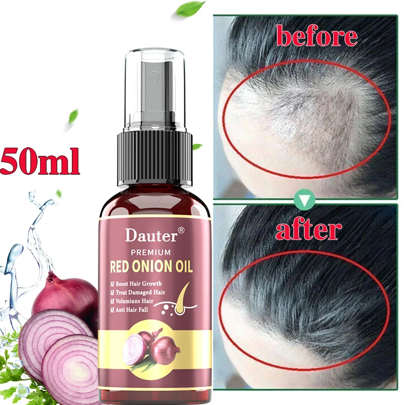Prirodni sprej protiv opadanja kose s eteričnim uljem, njeguje suhe i oštećene kose, brzo отрастает, obnavlja je i sprečava oštećenja kože glave. Slika 3